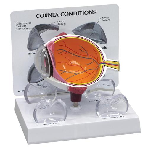 Cornea Eye Cross Section, 1019535, Eye Models