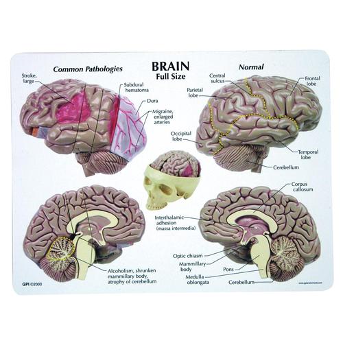 Brain Model, 1019542, Human Skull Models