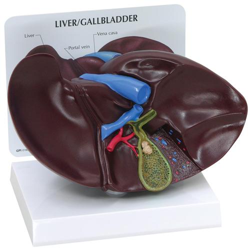 Liver/Gallbladder Model with Gallstones, 1019551, Digestive System Models
