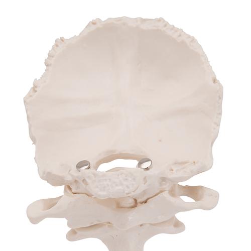 Atlas & Axis Model with Occipital Plate, Wire Mounted, on Removable Stand - 3B Smart Anatomy, 1000142 [A71/5], Individual Bone Models