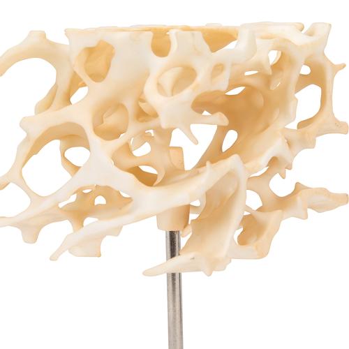 Human Cancellous Bone Model, Enlarged 100 times - 3B Smart Anatomy, 1009698 [A99], Microanatomy Models 