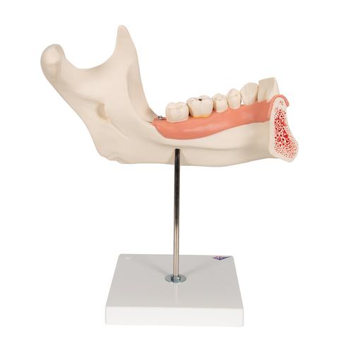 Half Lower Human Jaw Model, 3 times Full-Size, 6 part - 3B Smart Anatomy, 1000249 [D25], Dental Models