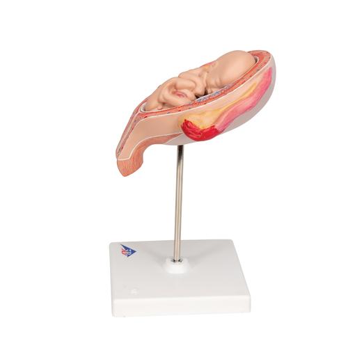 Fetus Model, 5th Month in Breech Position - 3B Smart Anatomy, 1018630 [L10/5], Human