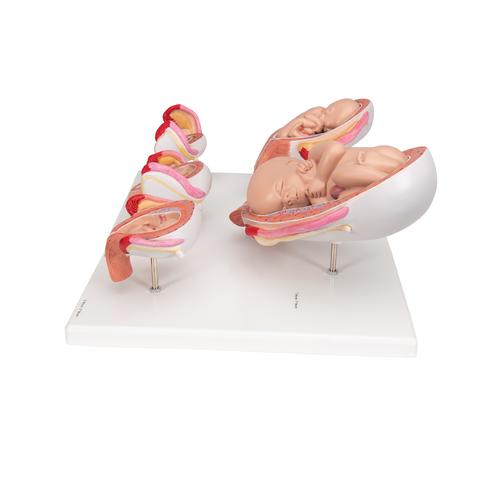 Pregnancy Models Series, 5 Embryo & Fetus Models on a Base - 3B Smart Anatomy, 1018633 [L11/9], Human