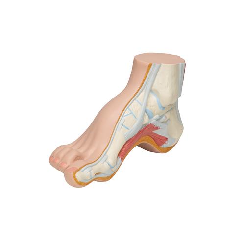 Hollow Foot (Pes Cavus) Model - 3B Smart Anatomy, 1000356 [M32], Joint Models