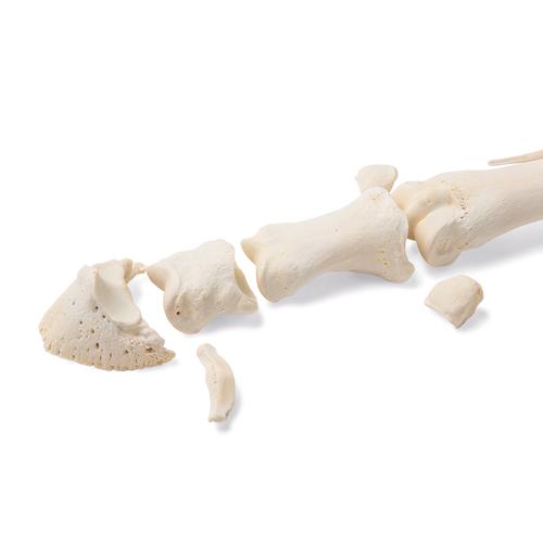 Horse metatarsal bones, 1021068 [T30069], Osteology