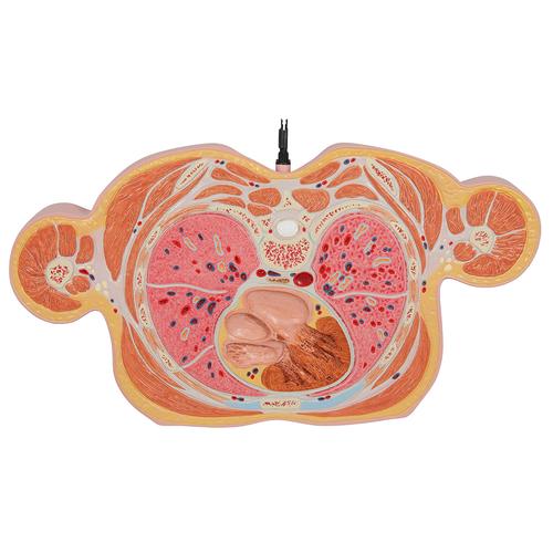 MRI Torso Model with 15 Transverse Sections - 3B Smart Anatomy, 1001237 [VA20], Human Torso Models