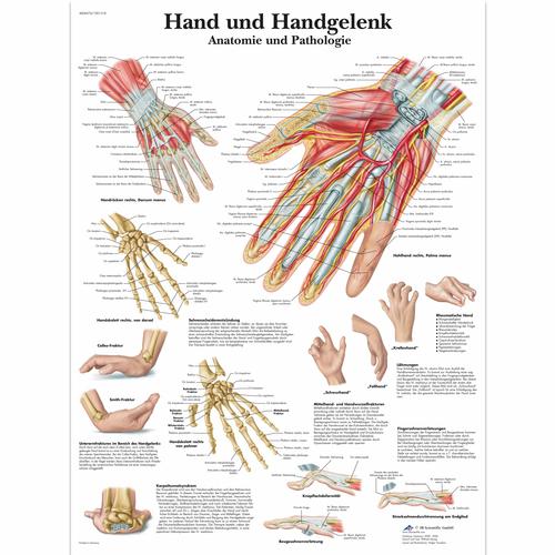 Hand und Handgelenk - Anatomie und Pathologie, 1001318 [VR0171L], Skeletal System