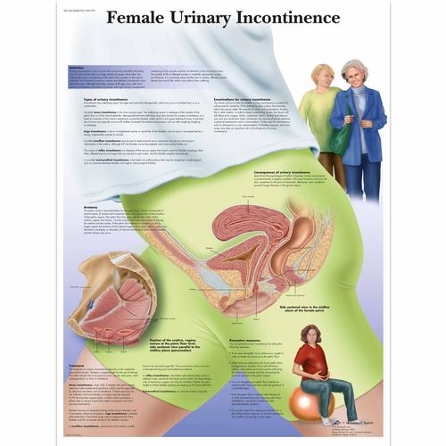 Female Urinary Incontinence Chart, 1001570 [VR1542L], Gynaecology