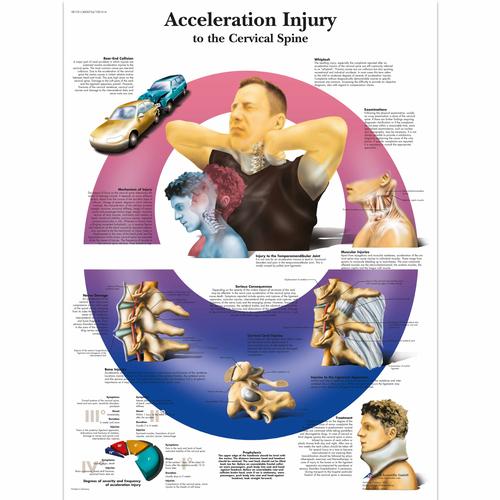 Acceleration Injury to the Cervical Spine Chart, 4006724 [VR1761UU], Skeletal System