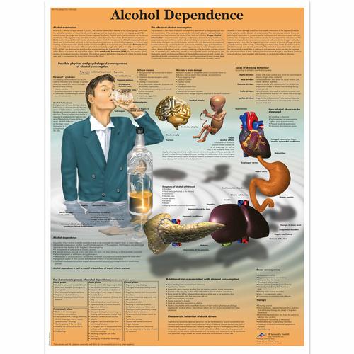 Alcohol Dependence Chart, 1001620 [VR1792L], Drug and Alcohol Education