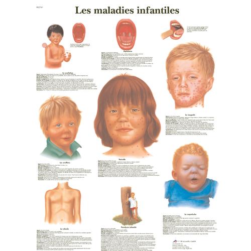 Les maladies infantiles, 1001780 [VR2741L], Parasitic, Viral or Bacterial Infection
