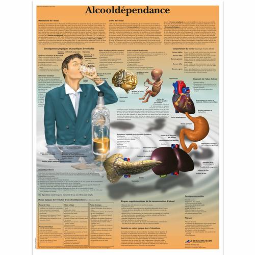 Alcoolodependance, 1001789 [VR2792L], Addiction