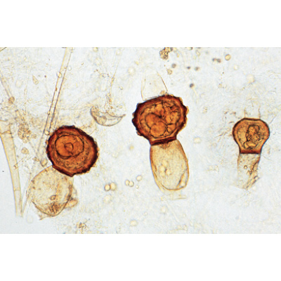 Fungi and Lichen - English Slides, 1003971 [W13042], English