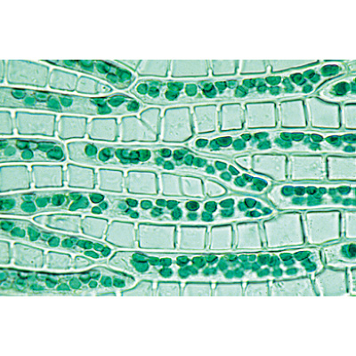 Bryophyta (Liverworts and Mosses) - English Slides, 1003972 [W13043], Microscope Slides LIEDER