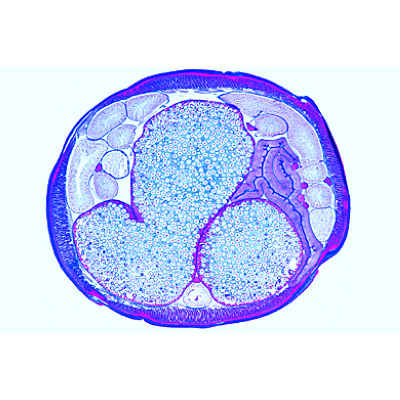The Ascaris megalocephala Embryology - German, 1013478 [W13084], Micro Slides