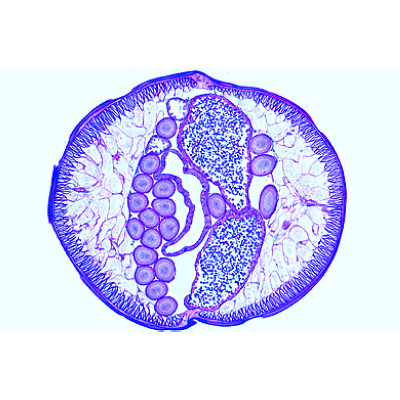The Ascaris megalocephala Embryology - German, 1013478 [W13084], Micro Slides