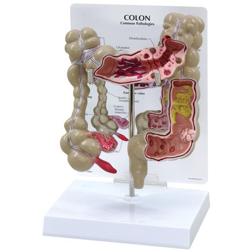 Colon Model, 1019554 [W33364], Digestive System Models