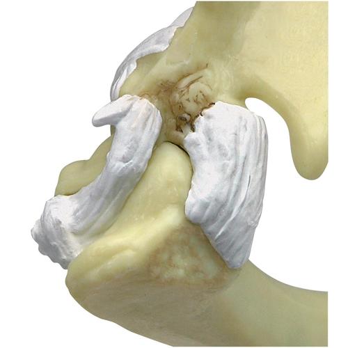 Feline Elbow-Shoulder Model, 1019588 [W33378], Osteology
