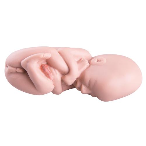Spare fetus for L10/5, 1018634 [XL003], Replacements