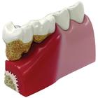 Teeth Model, 1019539, Dental Models