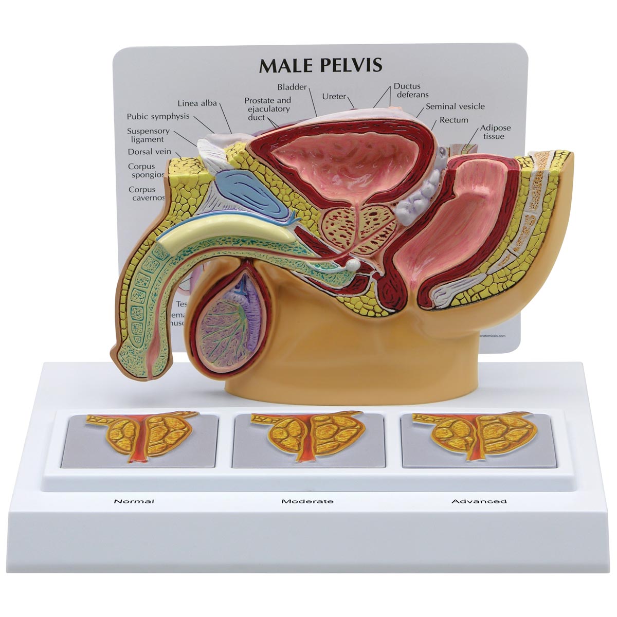 prostata anatomie 3d)