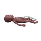 Micro-preemie Baby / Extremely Low Birth Weight Baby (ELBW)
, 1024668, Medical Simulators