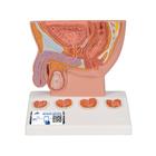 Prostate Model, 1/2 Natural Size - 3B Smart Anatomy, 1000319 [K41], Men's Health Education