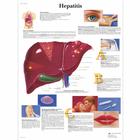 Hepatitis, 1001389 [VR0435L], Metabolic System