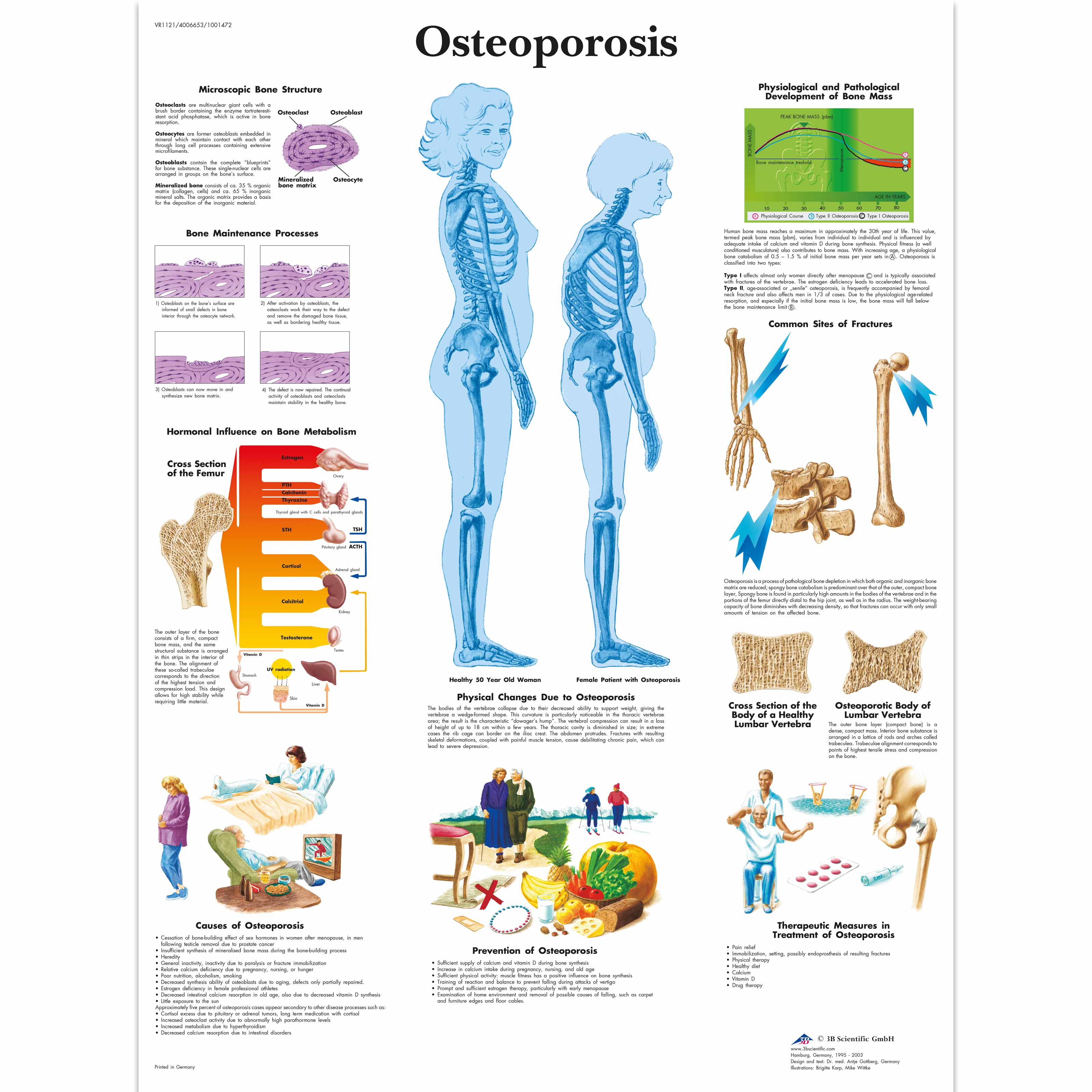 VR1121UU_01_3200_3200_Osteoporosis Chart