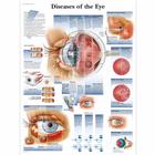 Diseases of the Eye Chart, 4006666 [VR1231UU], Ophthalmology