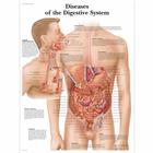 Diseases of the Digestive System Chart, 1001548 [VR1431L], Digestive System