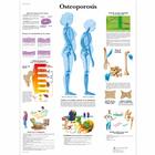 Osteoporosis, 4006816 [VR3121UU], Arthritis and Osteoporosis Education