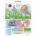 Cefaleas, 4006881 [VR3714UU], Brain and Nervous system